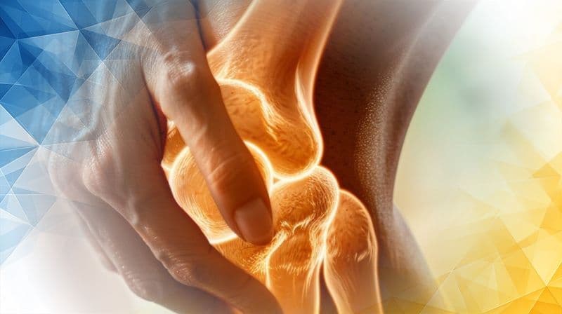 Arthrosamid Treatment for Patellofemoral Osteoarthritis Kneecap Pain Relief