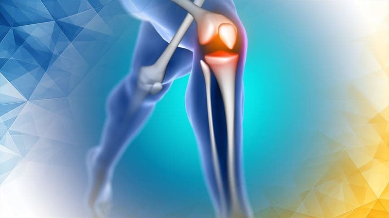 Partial Knee Replacement Longevity and Influencing Factors